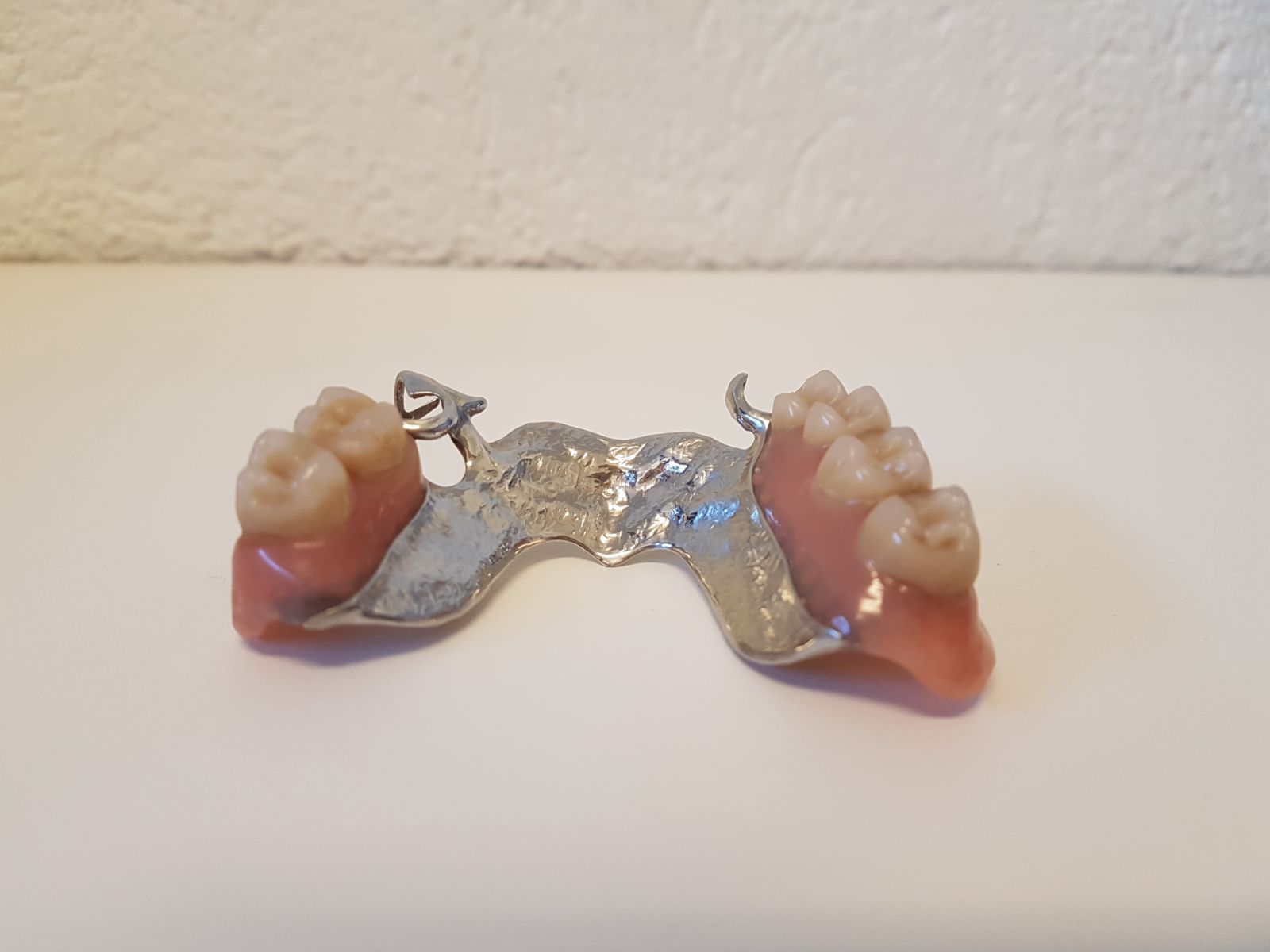 Une paire de prothèses dentaires cassées sur une surface blanche.