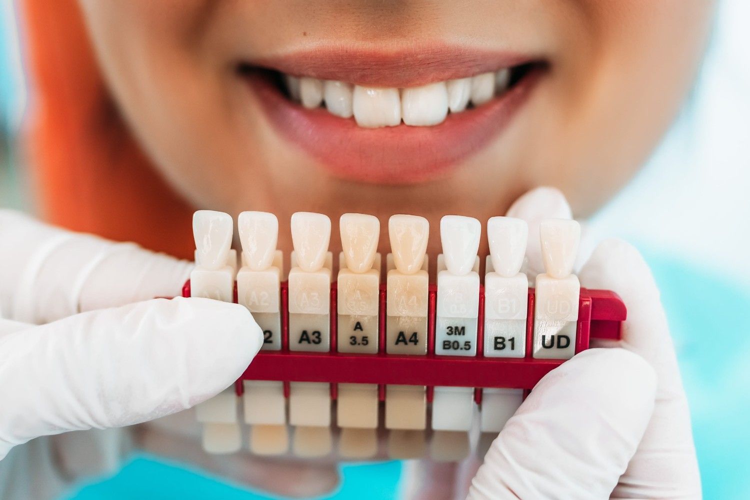 Dentista sosteniendo una guía de colores dentales frente a una boca sonriente.