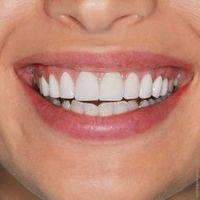 Praxis für Zahnheilkunde Tatjana Menkens-Siemers