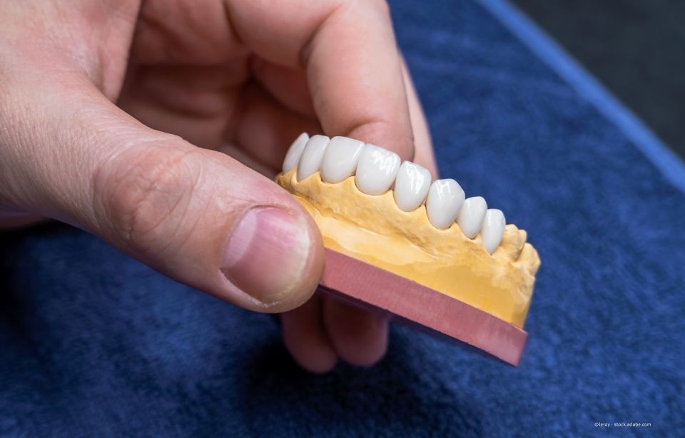 Hand hält ein Zahnmodell mit weißen Zähnen auf gelb-rosa Grund