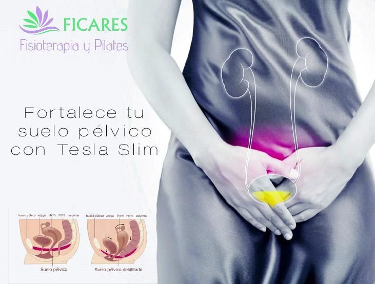 Imagen promocional para fisioterapia y pilates: mujer con zona pélvica resaltada, texto Tesla Slim y diagramas.