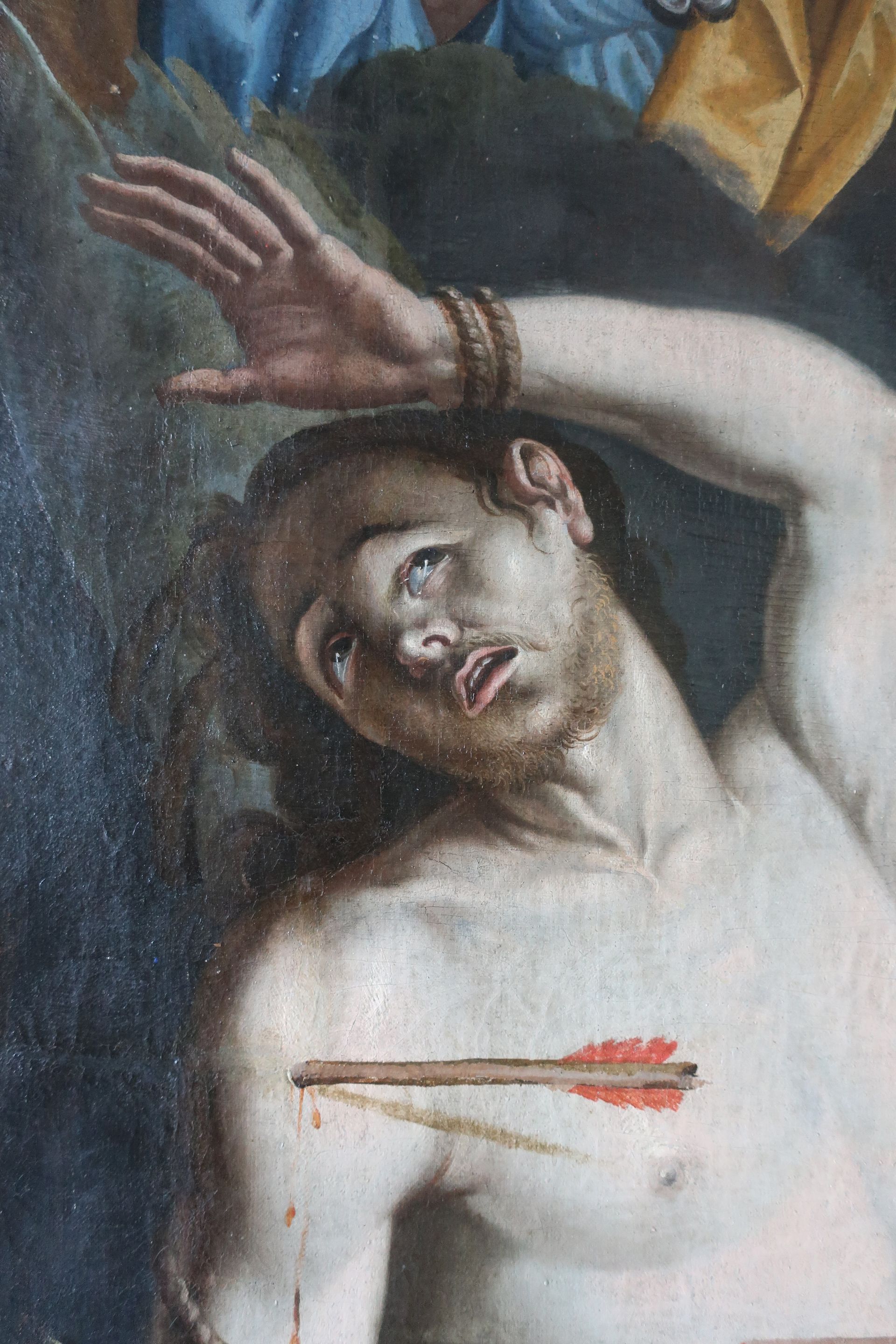 Restauration après : homme avec flèche