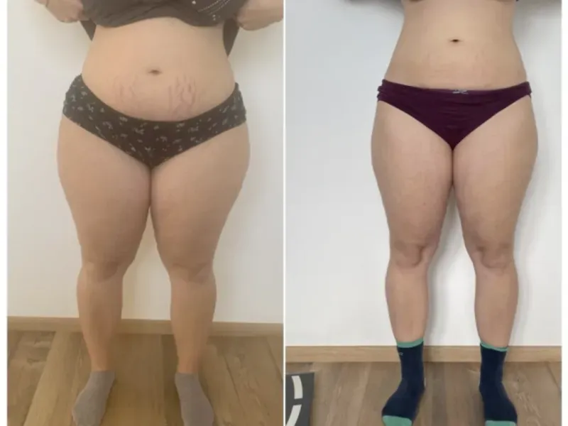 Ein Vorher-Nachher-Foto einer Frau in Unterwäsche und Socken