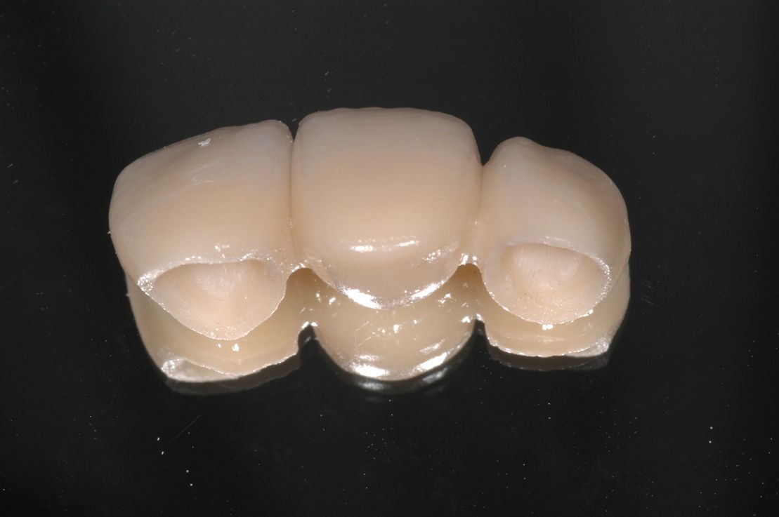 Zahnprotese- Praxis Schindellegi Zahnärztinnen