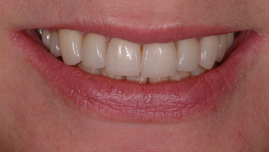 Mund - Praxis Schindellegi Zahnärztinnen