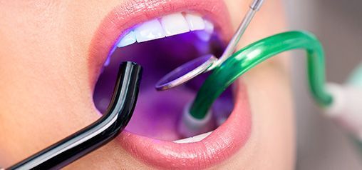 Una mujer se está blanqueando los dientes con un dentista.