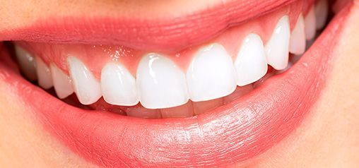 Un primer plano de la sonrisa de una mujer con dientes blancos y labios rosados.
