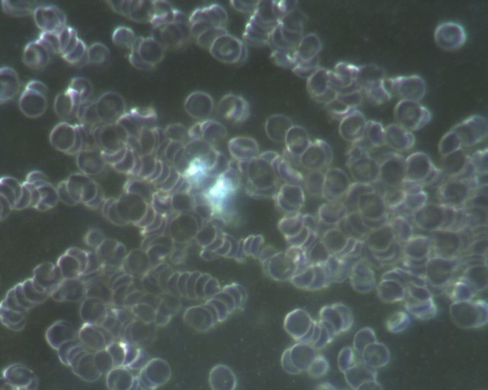 Praxis für ganzheitliche Diagnostik und Naturheilverfahren Schmidt Dresden Blutkörperchen unter dem Mikroskop