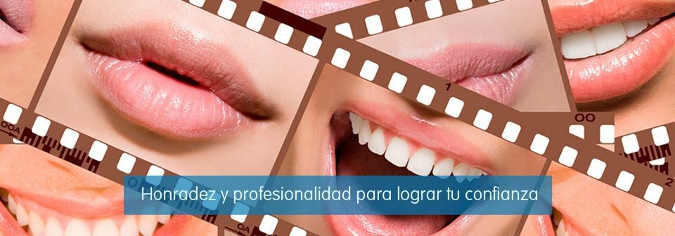 Collage de sonrisas con labios sonrientes en un anuncio de blanqueamiento dental cosmético con una franja de texto azul