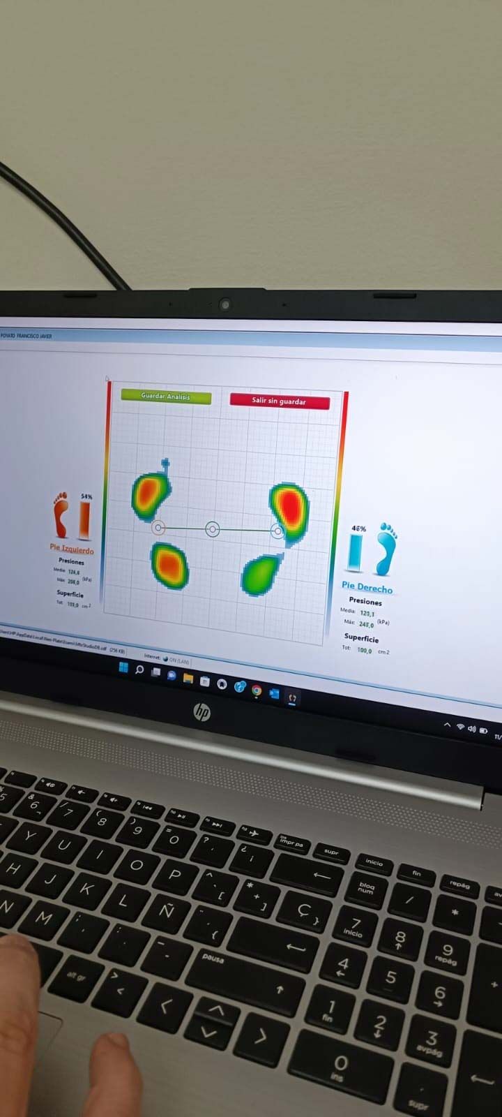 La pantalla de un portátil muestra un gráfico de mapa de calor con zonas verdes, amarillas y rojas.
