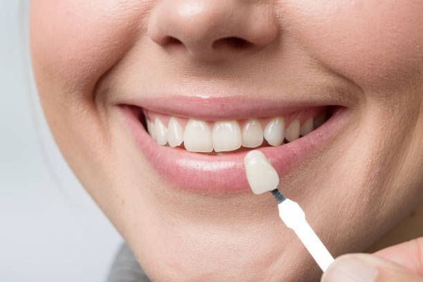 Una mujer sonríe mientras sostiene una máscara de dientes frente a sus dientes.