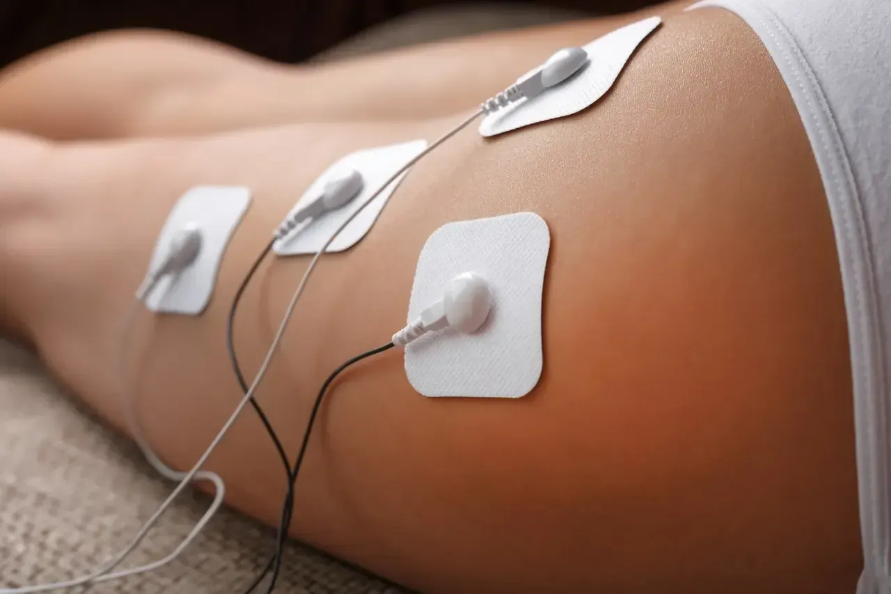 Electrodos adheridos a la pierna, probablemente para la estimulación muscular.