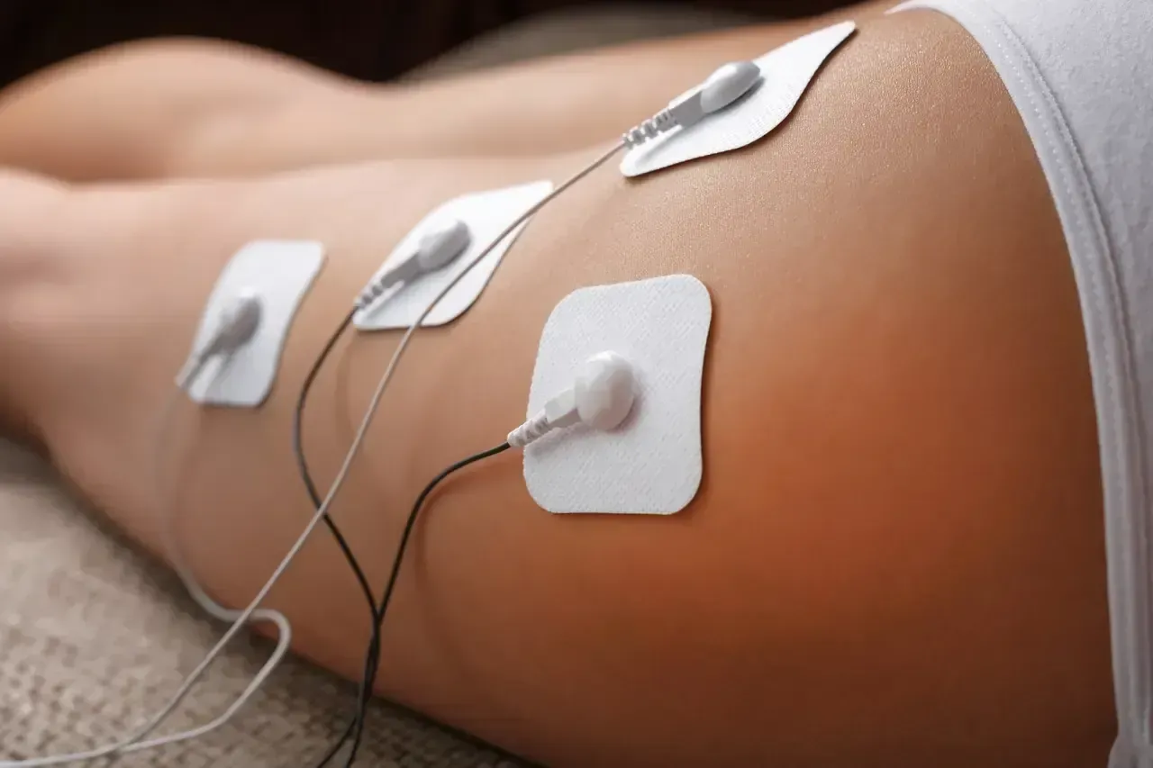 Electrodos adheridos a la pierna, probablemente para estimulación muscular.