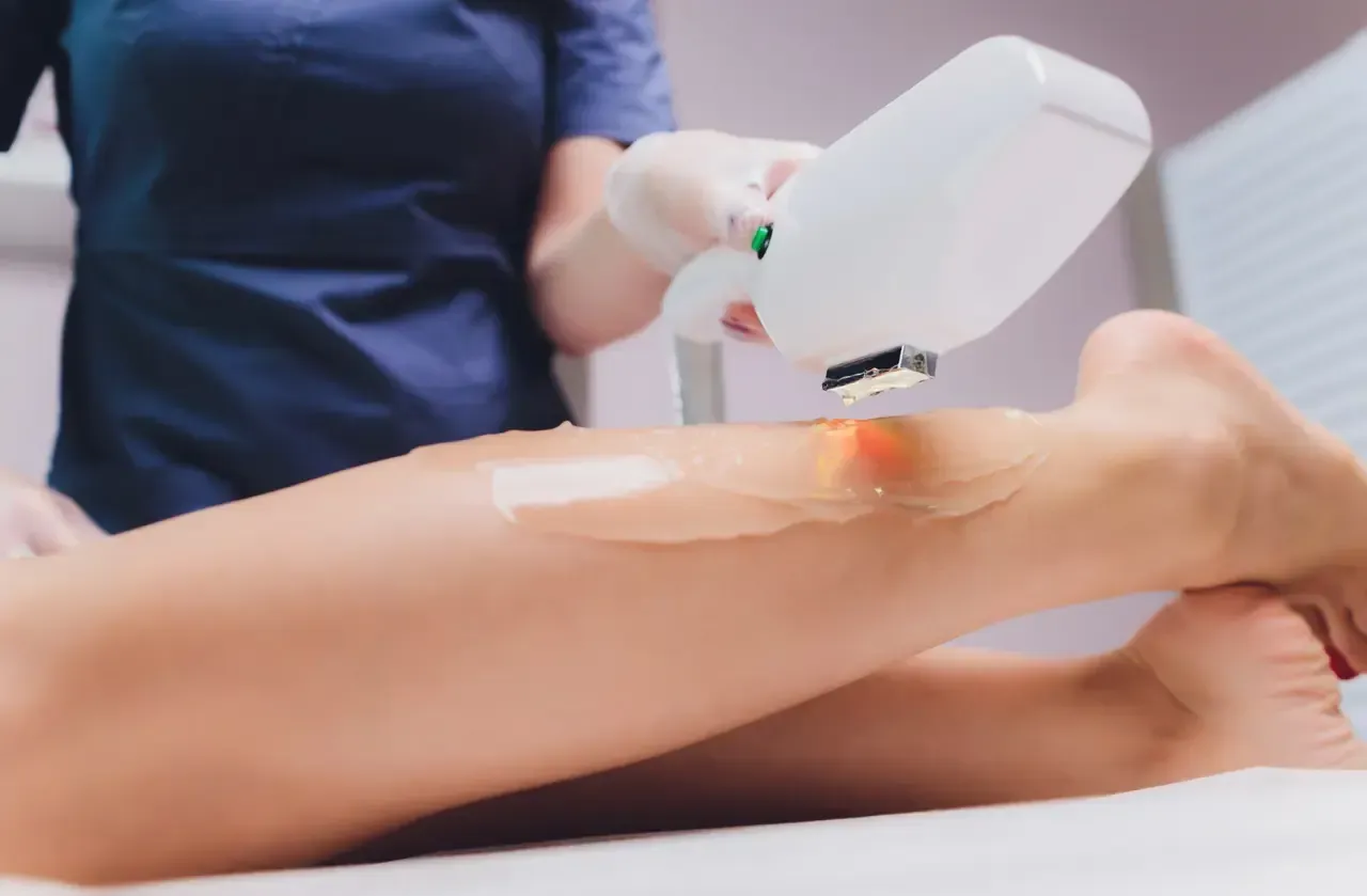 Depilación láser en una pierna; el técnico sostiene el dispositivo y lo aplica en la zona a tratar, en interiores.