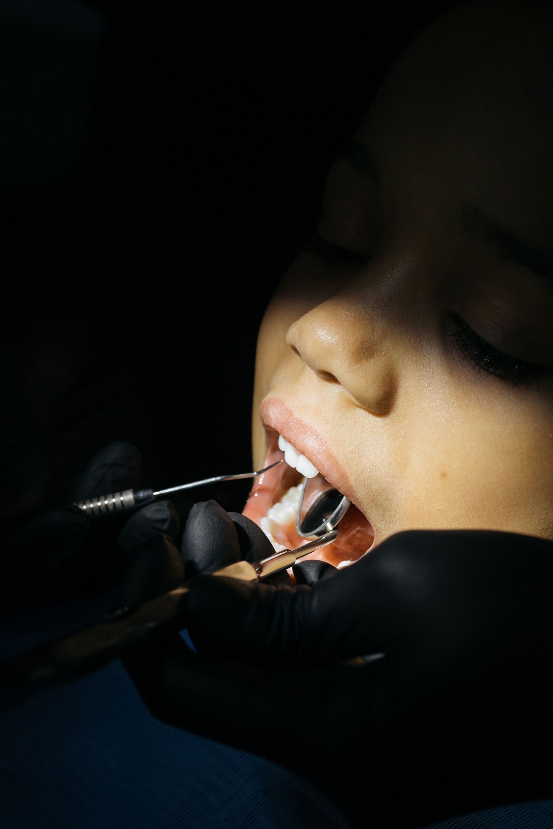 Primer plano de la boca de un niño durante un tratamiento dental