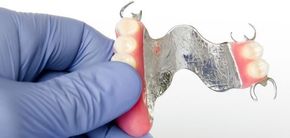 Una persona que lleva guantes azules sostiene una dentadura postiza en la mano.