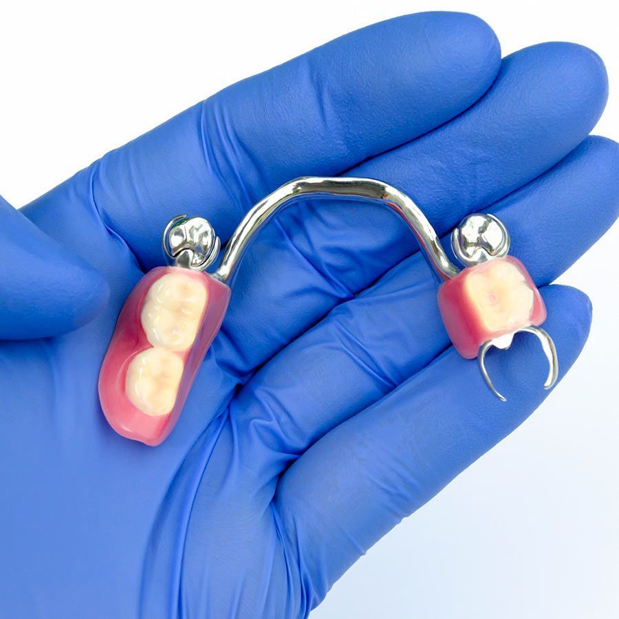 Una persona que lleva guantes azules sostiene una dentadura postiza en la mano.