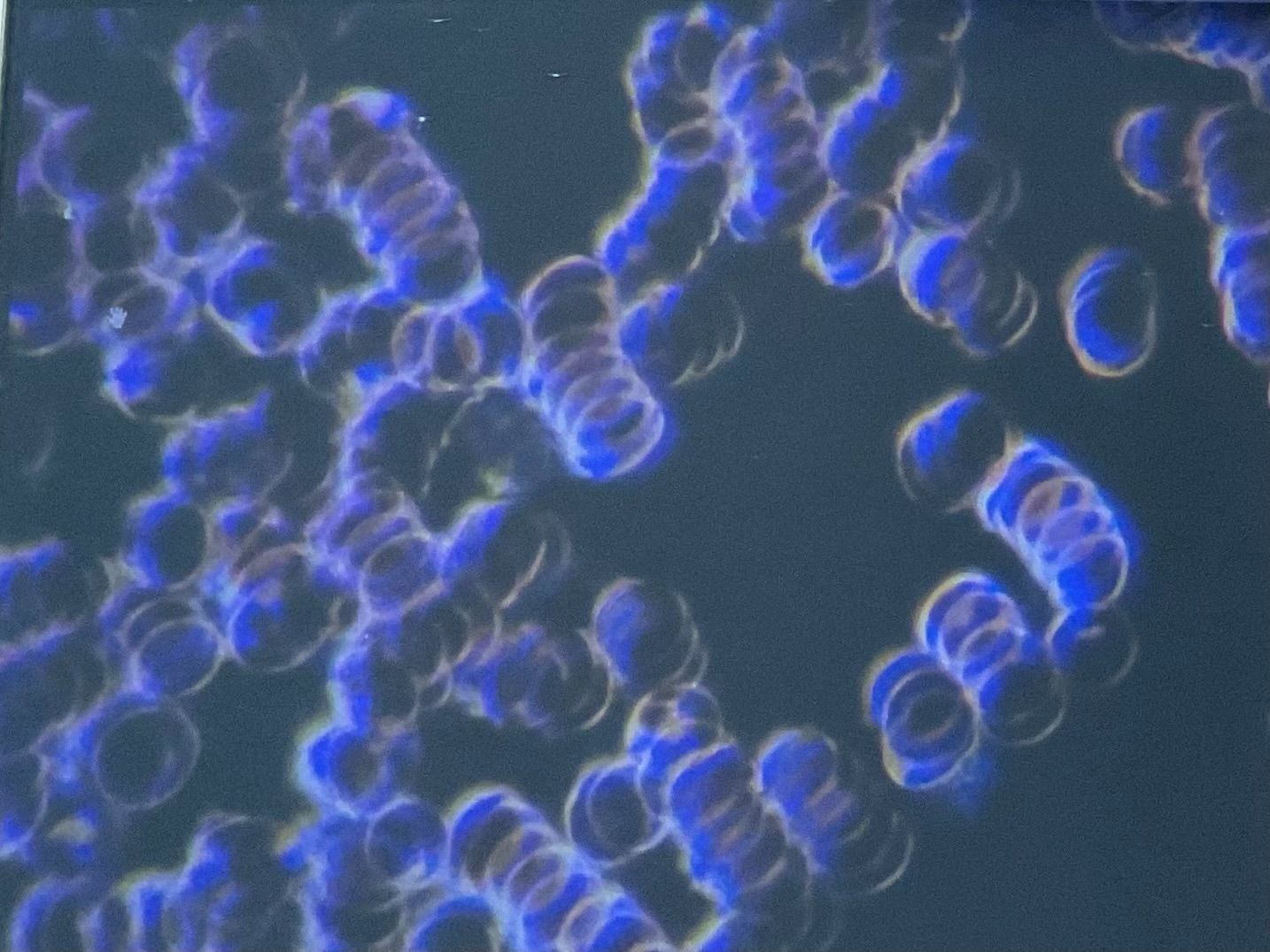 Blutbild vor Einnahme von Cili Sugaring
