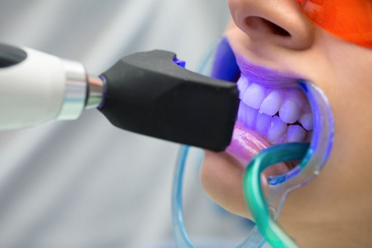Una mujer se está blanqueando los dientes en un consultorio dental.