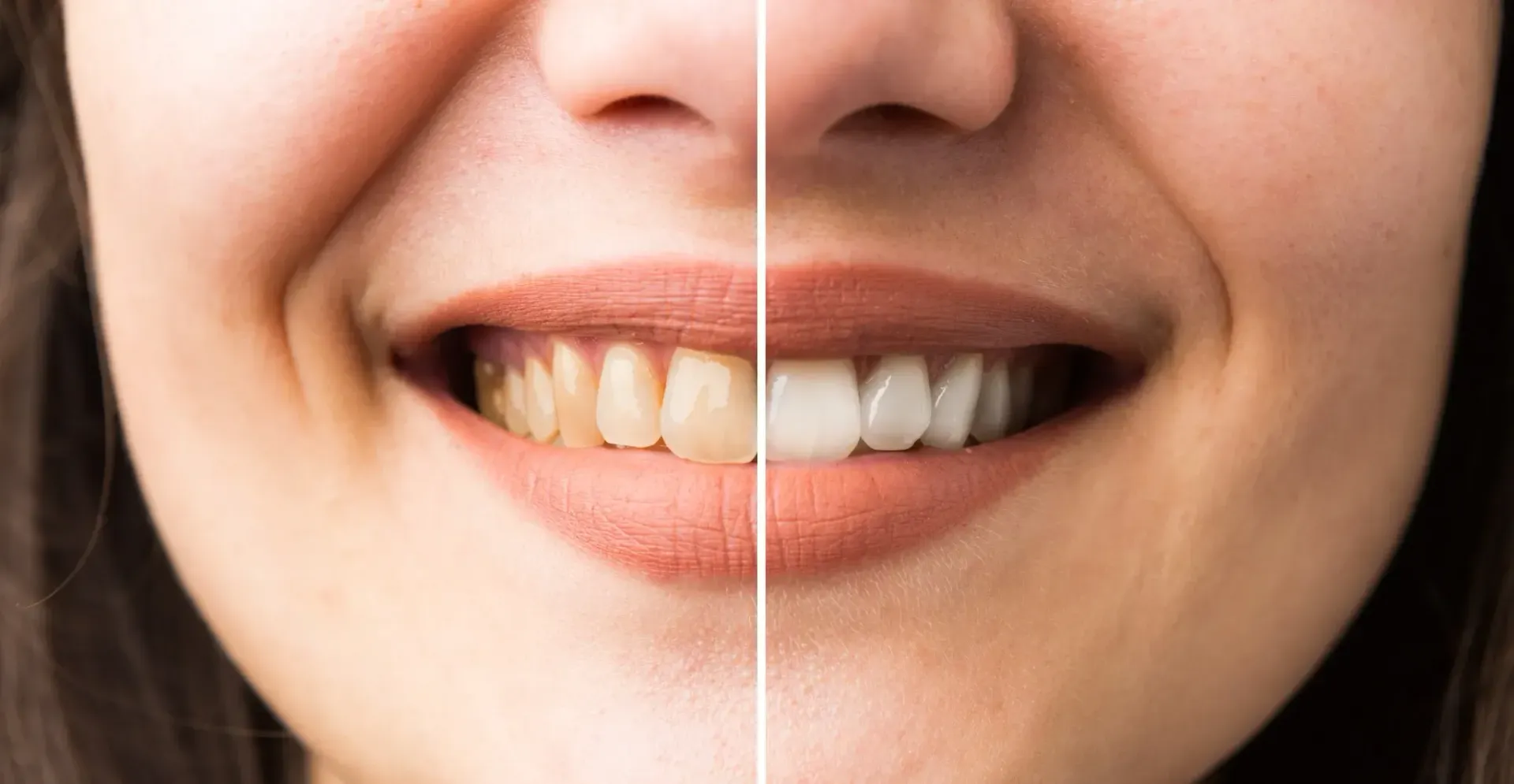 Primer plano de la boca sonriente de una persona. 