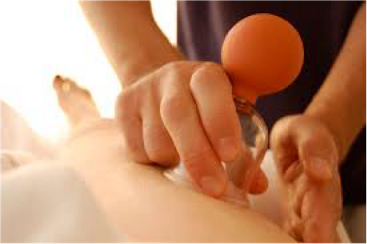 Schröpfen - Massagepraxis DAMU