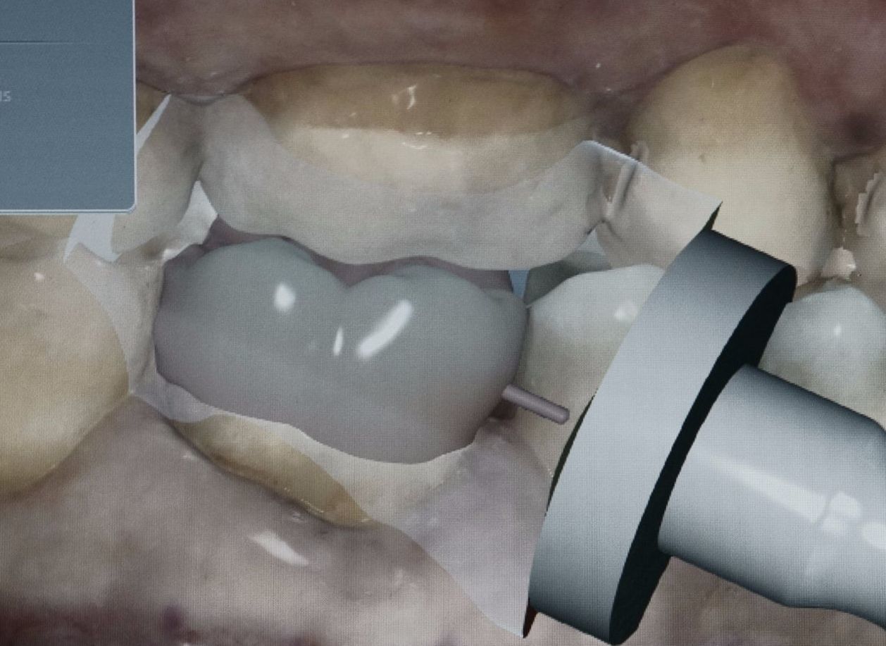 Zahnersatz - Team - Zahnarztpraxis Constance Mähler