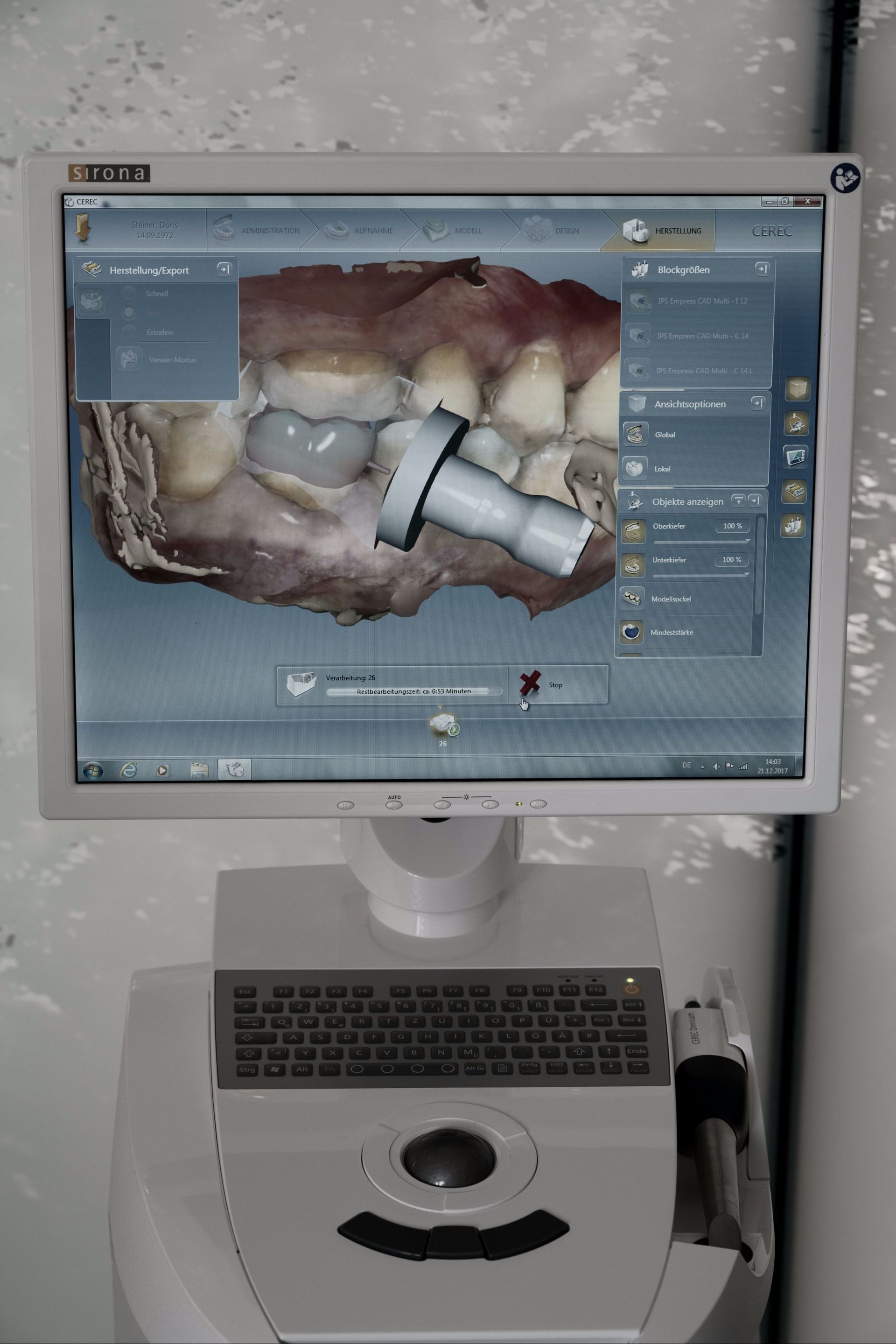 CEREC - Konstruktion