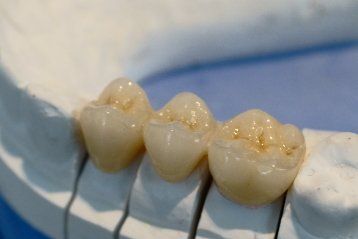 Zahnarztpraxis Constance Mähler | Madiswil