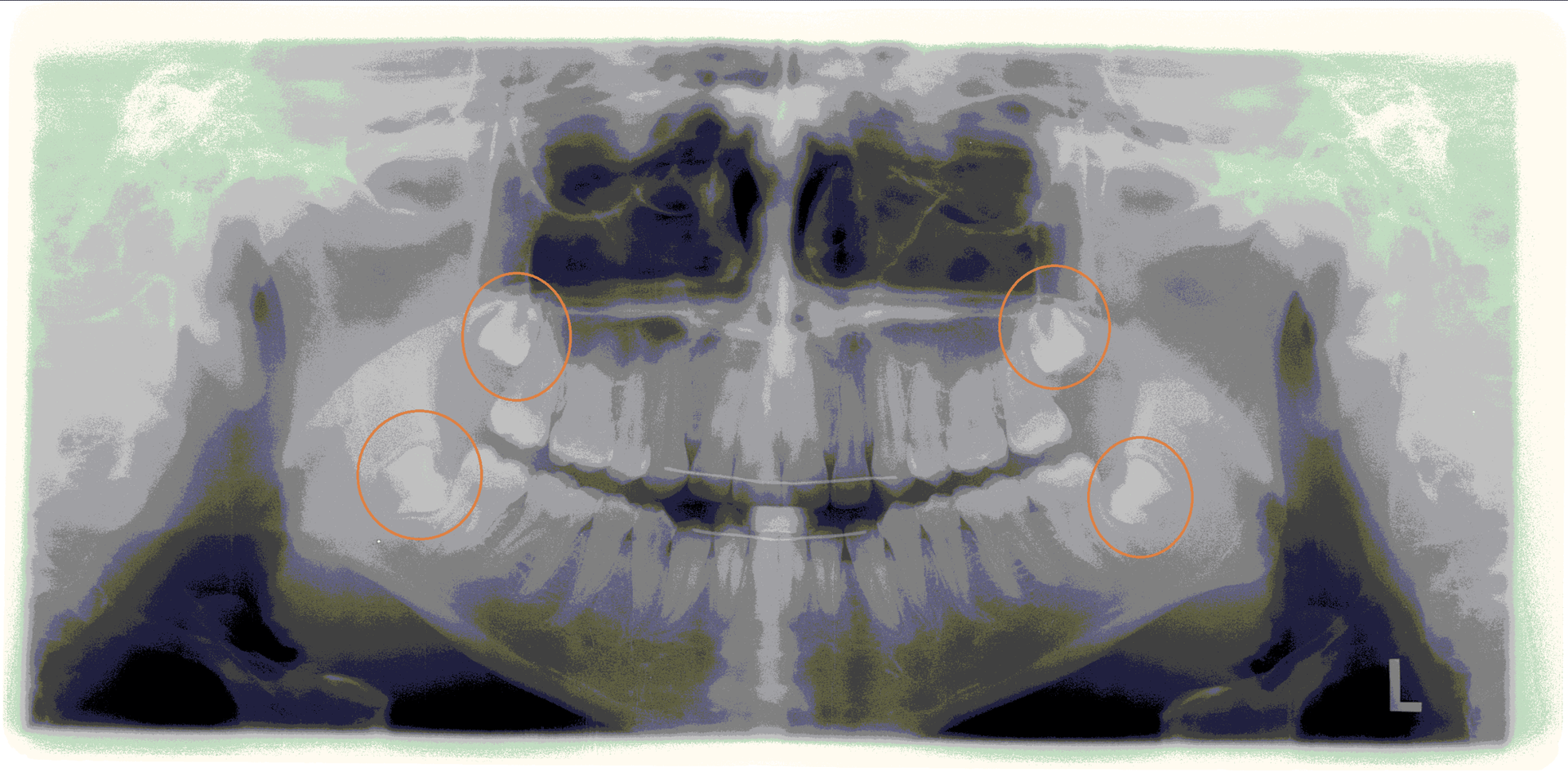 Weisheitszähne - Praxis - Team - Zahnarztpraxis Constance Mähler