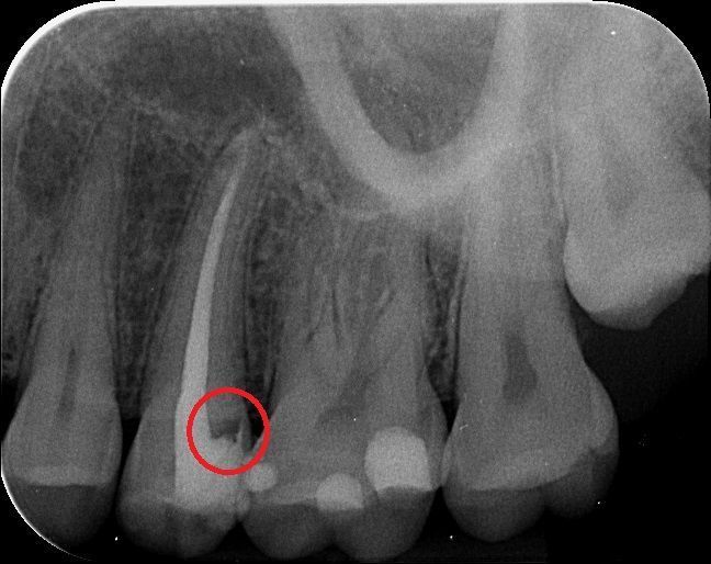 Undichte Füllung - Praxis - Team - Zahnarztpraxis Constance Mähler