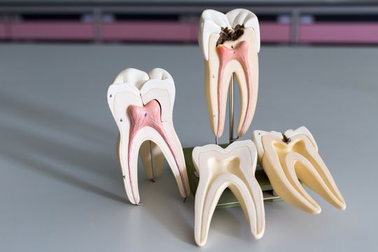 wurzelbehadlung - Seedent Ihre Zahnarztpraxis Dr. med. dent. Nies