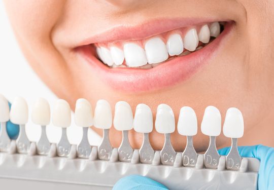 bleachen - Seedent Ihre Zahnarztpraxis Dr. med. dent. Nies