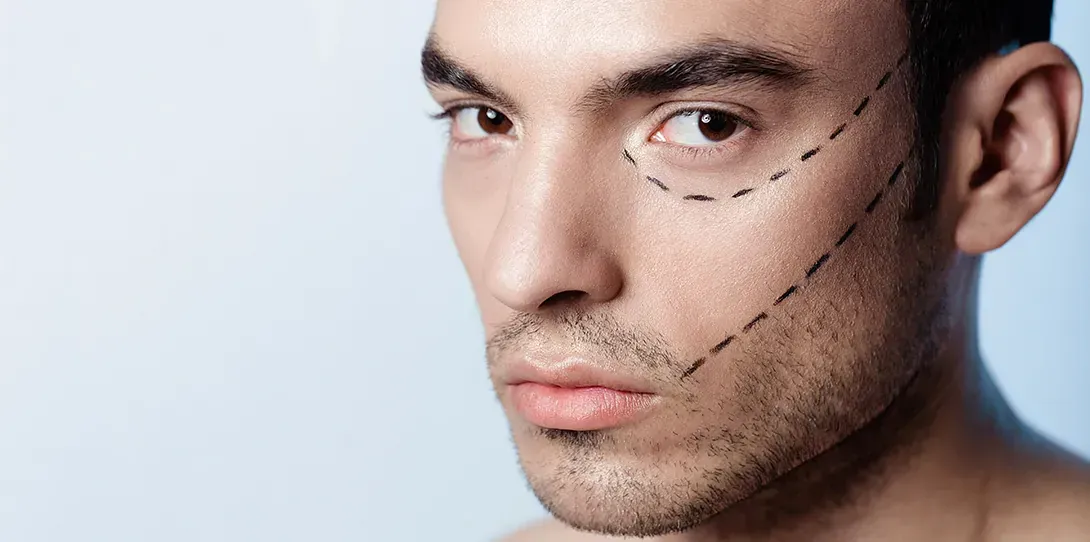 Un primer plano del rostro de un hombre con líneas dibujadas en él.