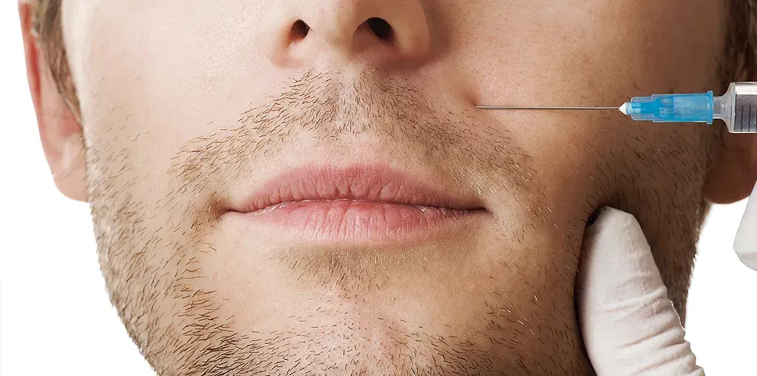Un hombre recibe una inyección de botox en la cara.