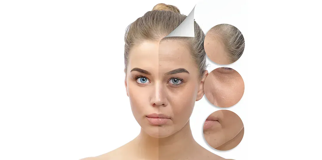 Se muestra el rostro de una mujer antes y después de un tratamiento.