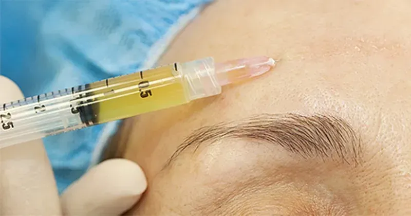 Una mujer recibe una inyección facial en la frente.