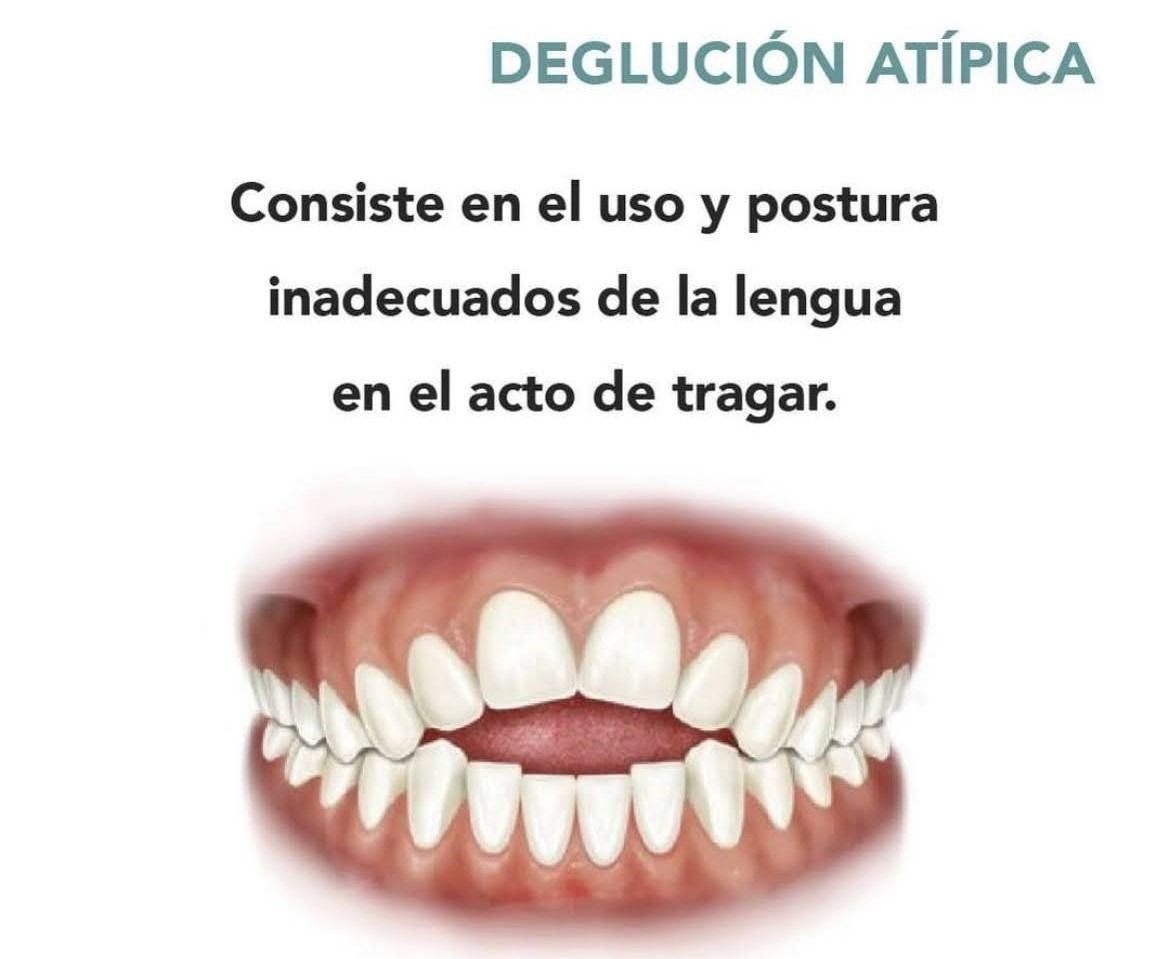 Una imagen de los dientes de una persona con las palabras 
