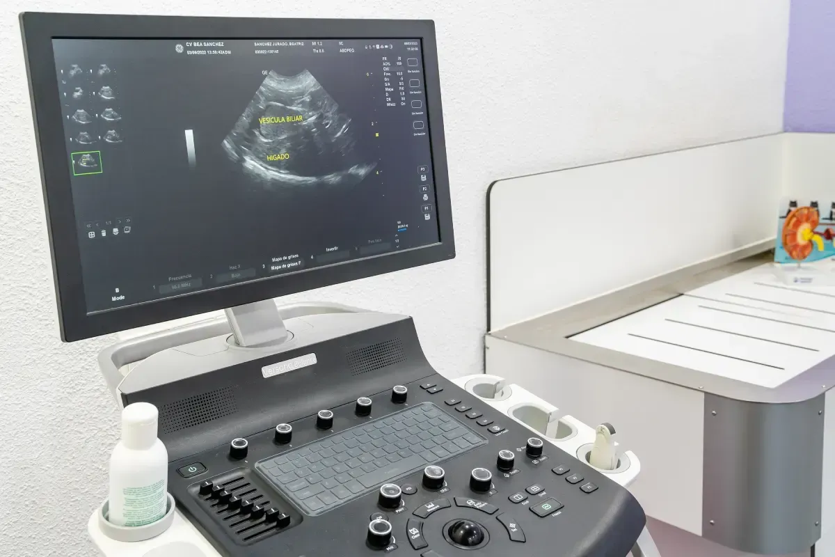 Máquina de ultrasonido que muestra una exploración de los órganos internos en un entorno médico.