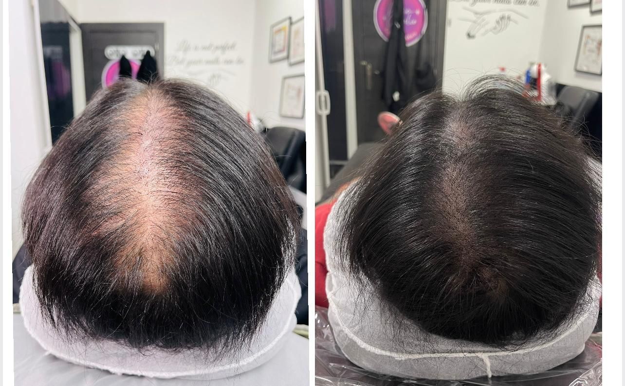 Una persona que lleva guantes negros se sujeta el cabello oscuro, dejando al descubierto