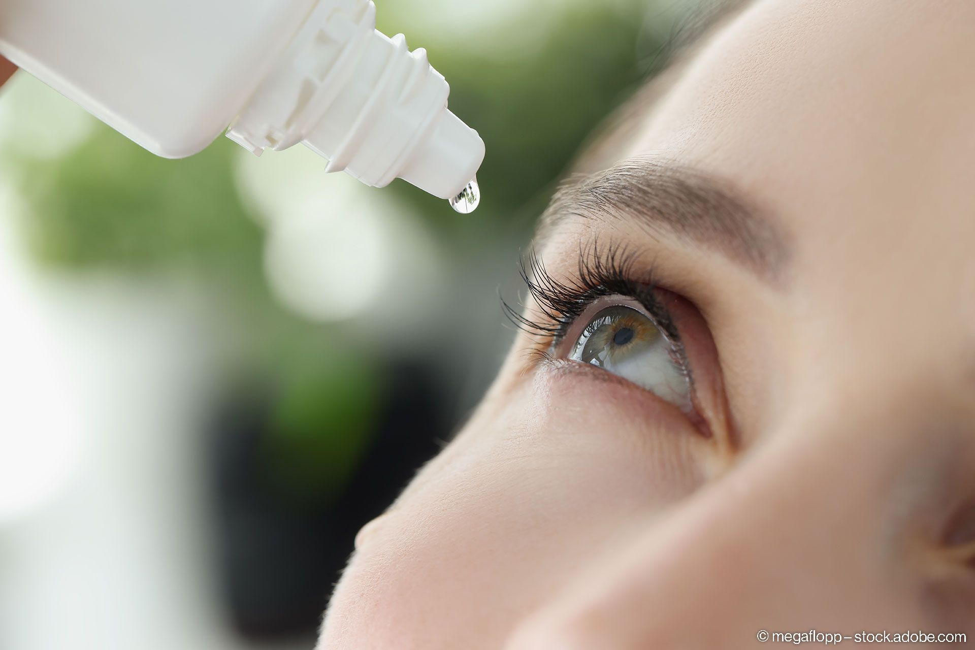 Frau tropft Augentropfen ins Auge für Allergien, Nahaufnahme.