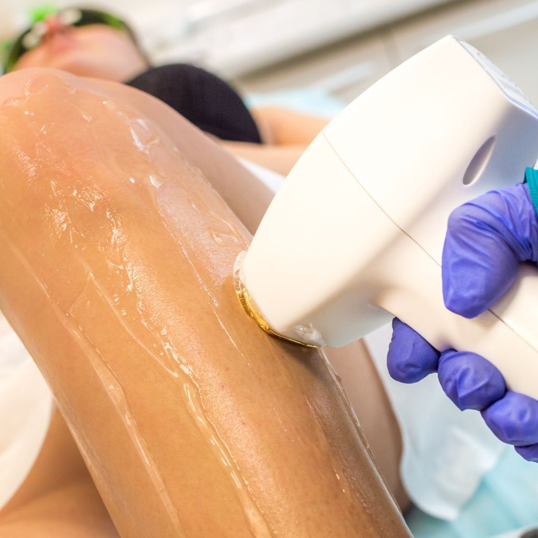 Una persona recibe depilación láser en la pierna por parte de un profesional con guantes en una clínica.