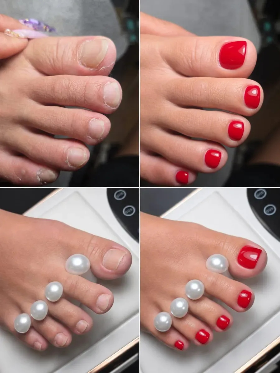 Collage de cuatro paneles sobre la transformación de las uñas de los pies: desde uñas al natural hasta una pedicura roja brillante con anillos de perlas en los dedos.