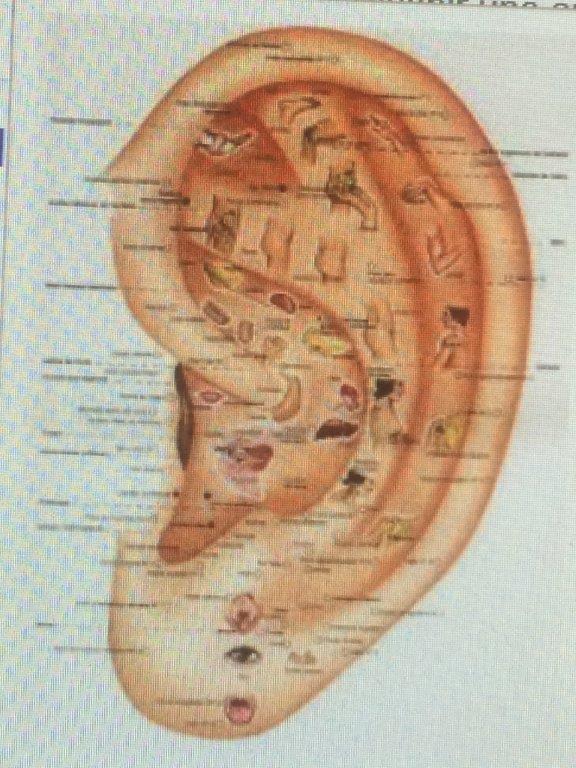 Auriculomédecine - Saint Denis de La Réunion