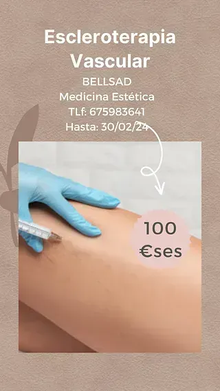 Anuncio de escleroterapia vascular: Inyección en la pierna. Precio: 100 euros. Finaliza el 30/02/2024.