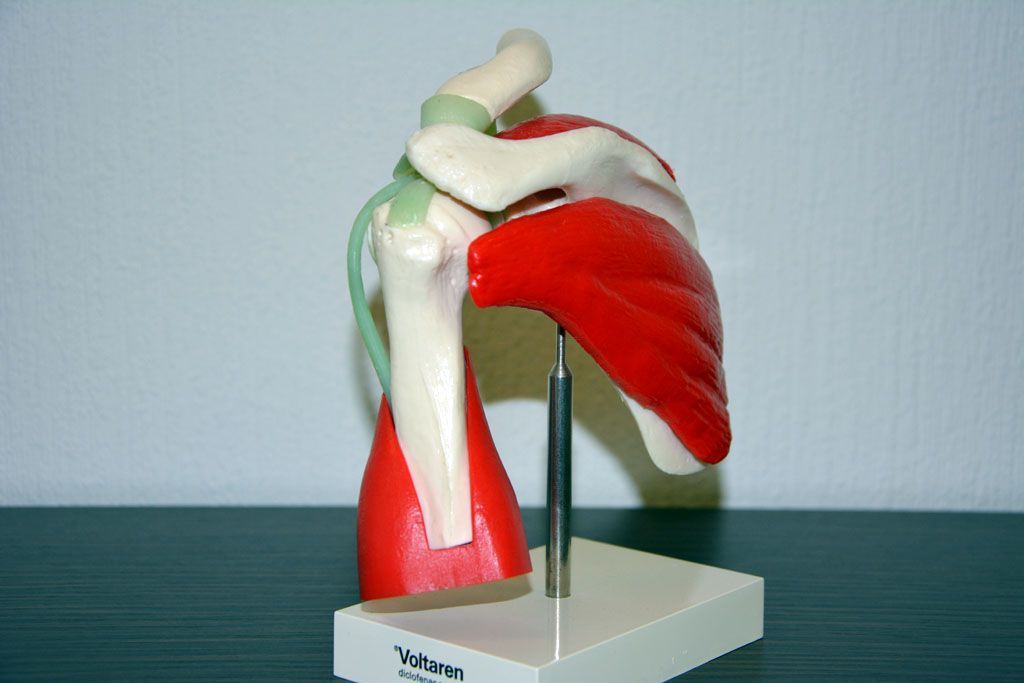 Chirurgie de l'épaule - Steve Brenn - Lausanne