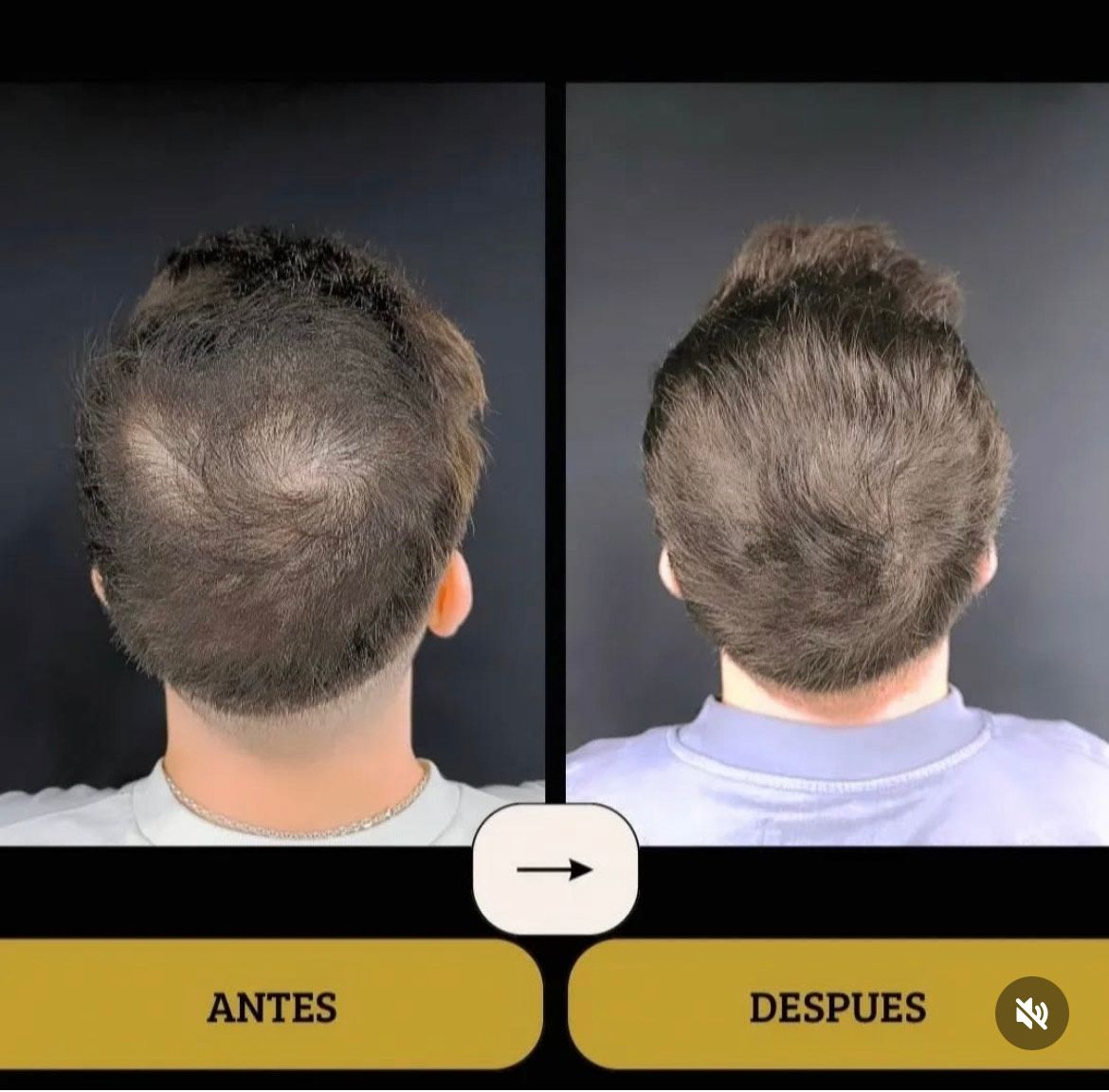 Una foto de antes y después del cabello de un hombre.
