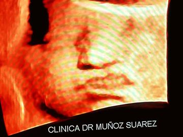 Primer plano de un rostro pixelado en una pantalla con el texto “CLÍNICA DR. MUÑOZ SUÁREZ” en la parte inferior.