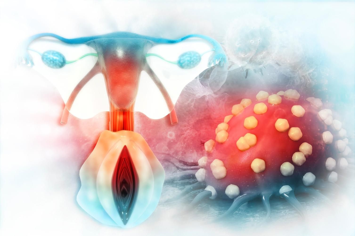 Ilustración médica abstracta de un útero junto a una esfera roja similar a un virus con espículas amarillas.