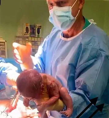 Personal médico sosteniendo a un recién nacido en un quirófano bajo luces quirúrgicas brillantes.