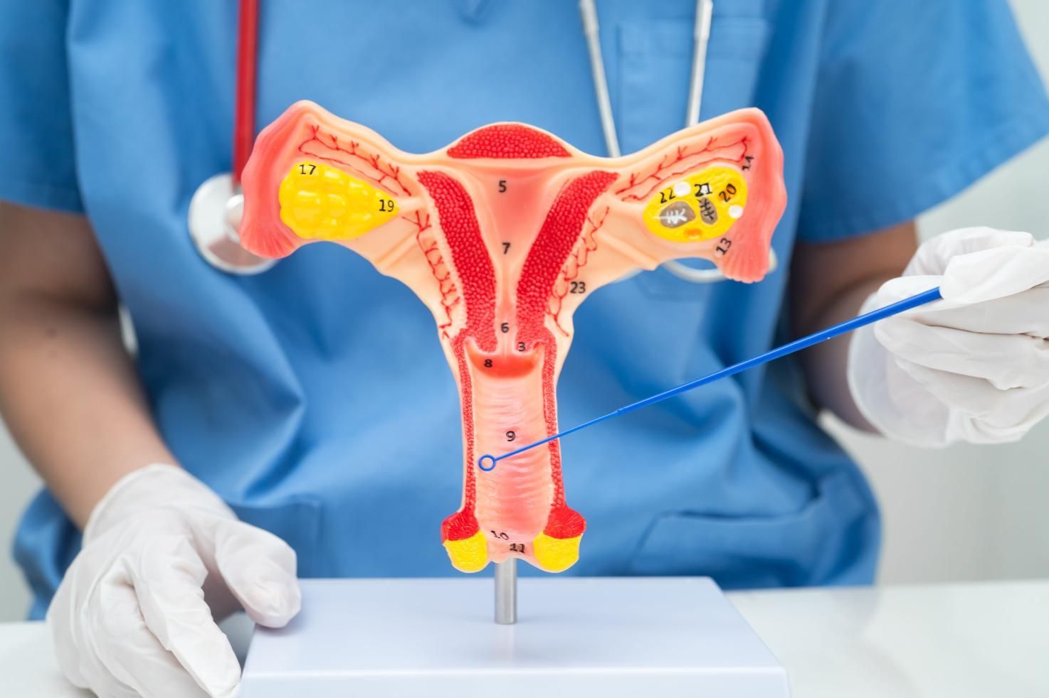 Modelo anatómico de útero y ovarios sostenido por manos enguantadas en un entorno médico.